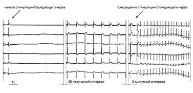 Создание биологического водителя ритма сердца