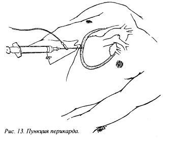 А.А.Золотарев, Р.А.Чириков лечение выпотных перикардитов