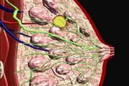 Мастопатия: как сохранить здоровую грудь