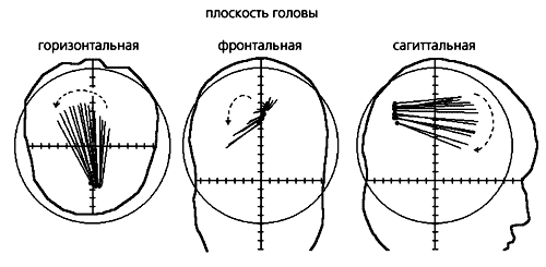 Волновые процессы в зрительной коре мозга