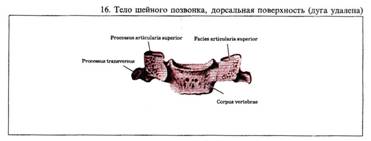 Шейный остеохондроз